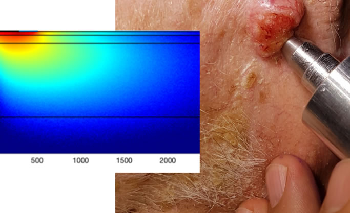 SpectroLive clinique